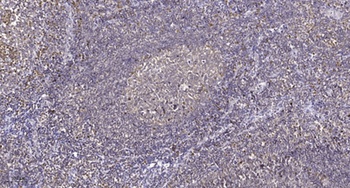 Histone H3.3 (phospho Ser31) rabbit pAb Antibody