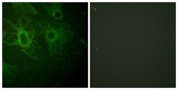 Hck (phospho Tyr410) rabbit pAb Antibody
