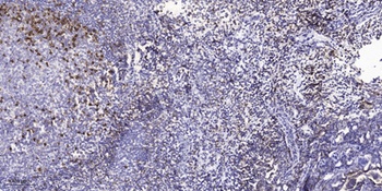 Hck (phospho Tyr410) rabbit pAb Antibody