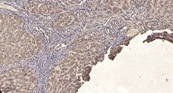 Lck BP-1 (phospho Tyr397) rabbit pAb Antibody