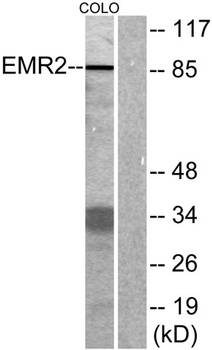 EMR2 rabbit pAb Antibody