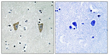 DREAM (phospho Ser63) rabbit pAb Antibody
