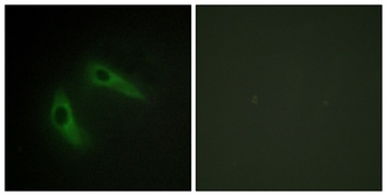 KChIP1 rabbit pAb Antibody