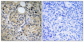 Hint1 rabbit pAb Antibody
