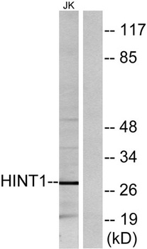 Hint1 rabbit pAb Antibody