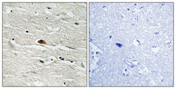HMG-14 (phospho Ser21) rabbit pAb Antibody