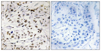 HMG-14 (phospho Ser21) rabbit pAb Antibody