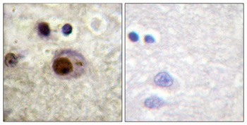hnRNP C1/2 (phospho Ser260) rabbit pAb Antibody