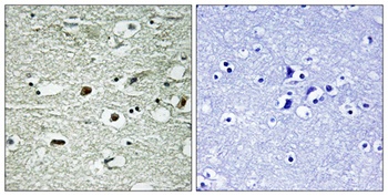 hnRNP C1/2 (phospho Ser260) rabbit pAb Antibody