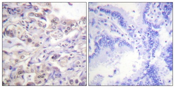 hnRNP D0 (phospho Ser83) rabbit pAb Antibody