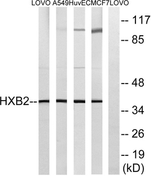 HoxB2 rabbit pAb Antibody