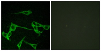 Histamine H2 Receptor rabbit pAb Antibody
