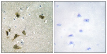 Survivin (phospho Thr117) rabbit pAb Antibody