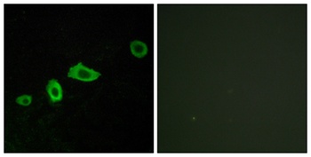 SR-5A rabbit pAb Antibody