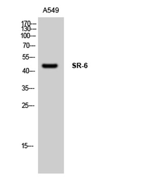 SR-6 rabbit pAb Antibody