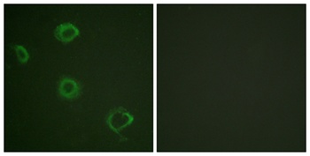 IFN-γRα (phospho Tyr457) rabbit pAb Antibody