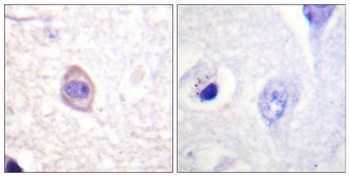 IFN-γRα (phospho Tyr457) rabbit pAb Antibody