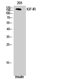 IGF-IR rabbit pAb Antibody