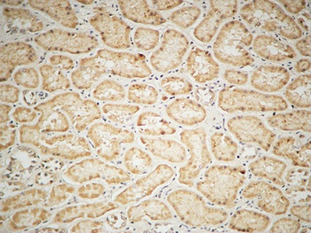 IGF-IR rabbit pAb Antibody