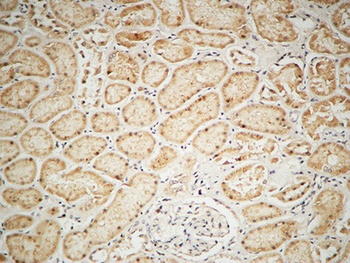 IGF-IR rabbit pAb Antibody