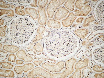 IGF-IR rabbit pAb Antibody