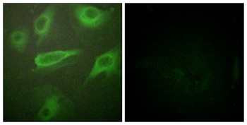 IL-4Rα (phospho Tyr497) Rabbit Polyclonal  Antibody
