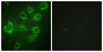 MRLC2 (phospho Ser20) rabbit pAb Antibody
