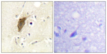 MRLC2 (phospho Ser20) rabbit pAb Antibody