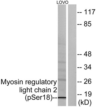 MRLC2 (phospho Ser20) rabbit pAb Antibody
