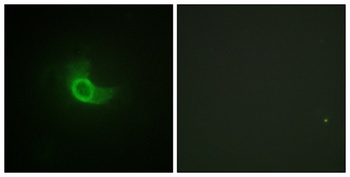 CD130 rabbit pAb Antibody