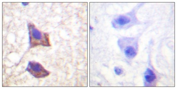 CD130 rabbit pAb Antibody