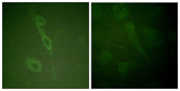 IL-7R (phospho Tyr449) rabbit pAb Antibody