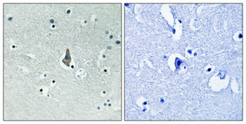 IL-8Rβ (phospho Ser347) rabbit pAb Antibody