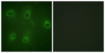 IL-8Rβ (phospho Ser347) rabbit pAb Antibody