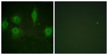 IL-9R (phospho Ser519) rabbit pAb Antibody