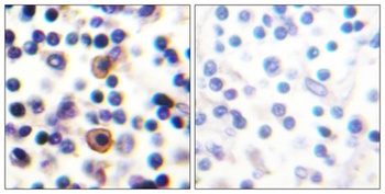 IL-9R (phospho Ser519) rabbit pAb Antibody
