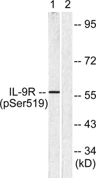 IL-9R (phospho Ser519) rabbit pAb Antibody