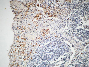 IL-12A rabbit pAb Antibody