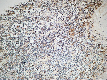 IL-12A rabbit pAb Antibody