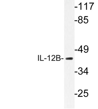 IL-12B rabbit pAb Antibody