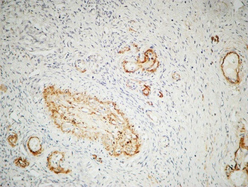 ILK rabbit pAb Antibody