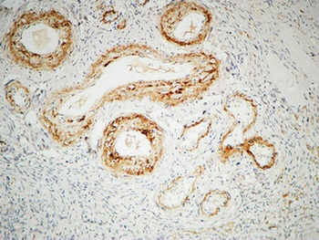 ILK rabbit pAb Antibody