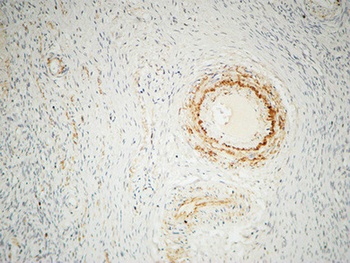 ILK rabbit pAb Antibody