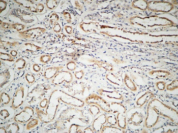 ILK rabbit pAb Antibody