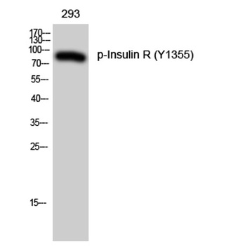 Insulin R (phospho Tyr1355) rabbit pAb Antibody