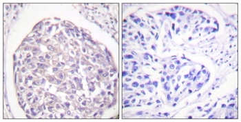 Insulin R (phospho Tyr1355) rabbit pAb Antibody