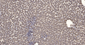 IRAK-1 (phospho Thr209) rabbit pAb Antibody