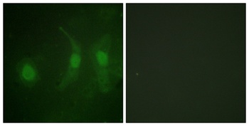 IRF-3 (phospho Ser385) rabbit pAb Antibody