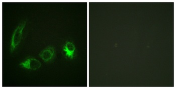 IRS-1 (phospho Ser323) rabbit pAb Antibody
