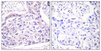 IRS-1 (phospho Ser323) rabbit pAb Antibody